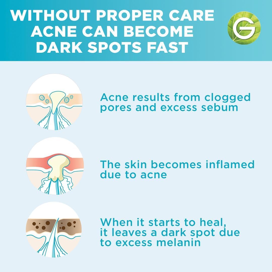 Garnier Skinactive Fast Clear Booster Face Serum, With Salicylic Acid, 30ml