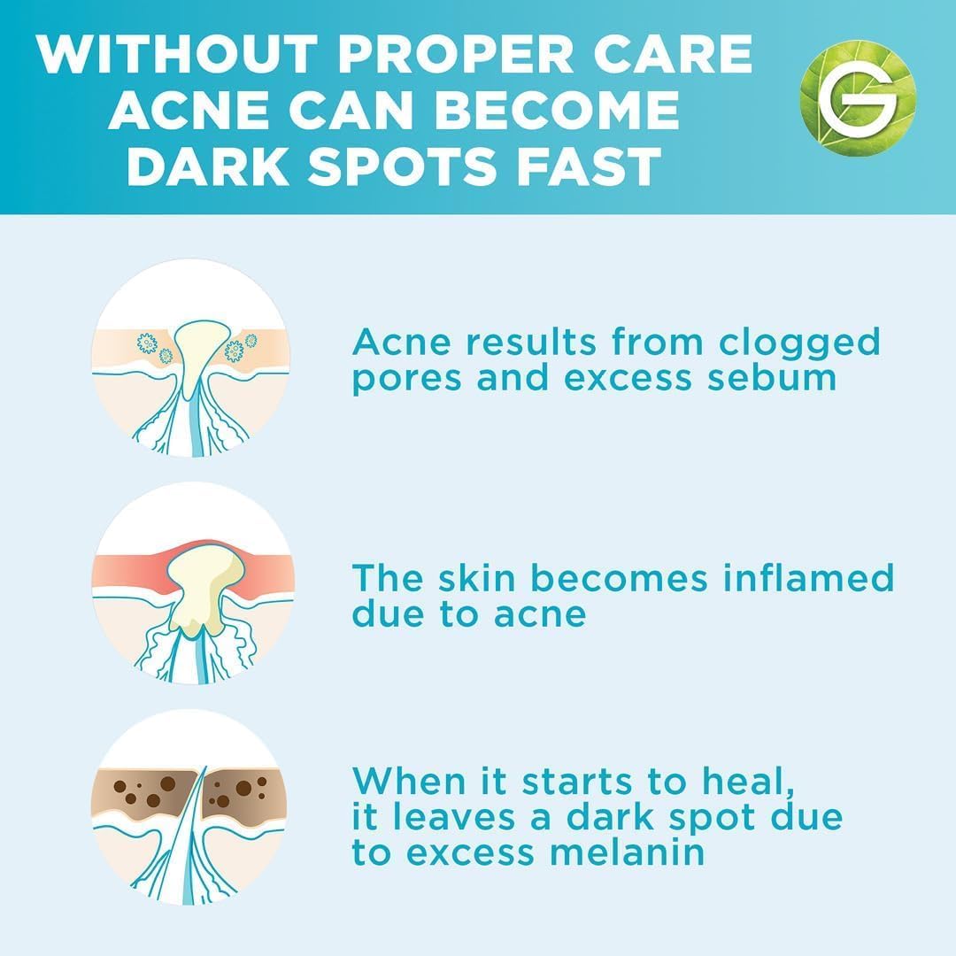 Garnier Skinactive Fast Clear Booster Face Serum, With Salicylic Acid, 30ml