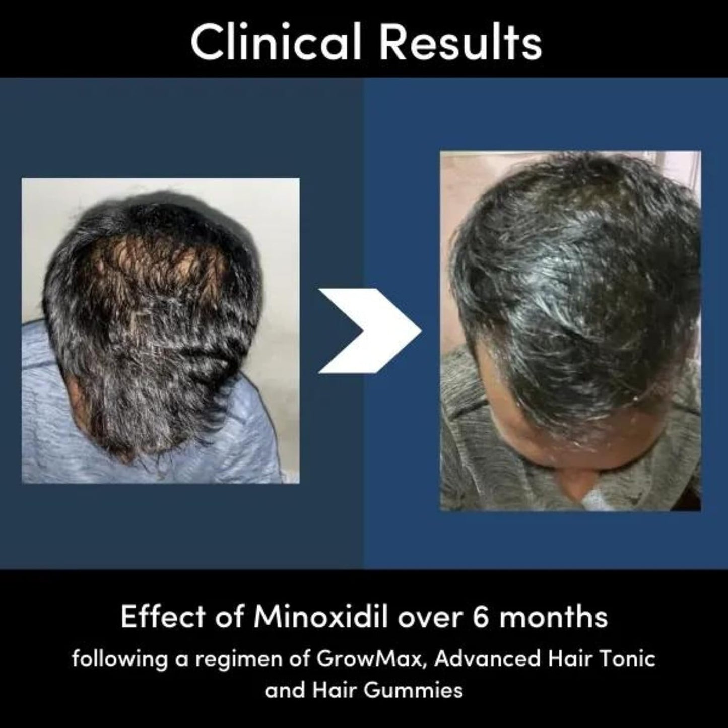 Minoxidil 50ml
