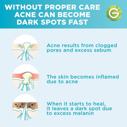 Garnier Skinactive Fast Clear Booster Face Serum, With Salicylic Acid, 30ml