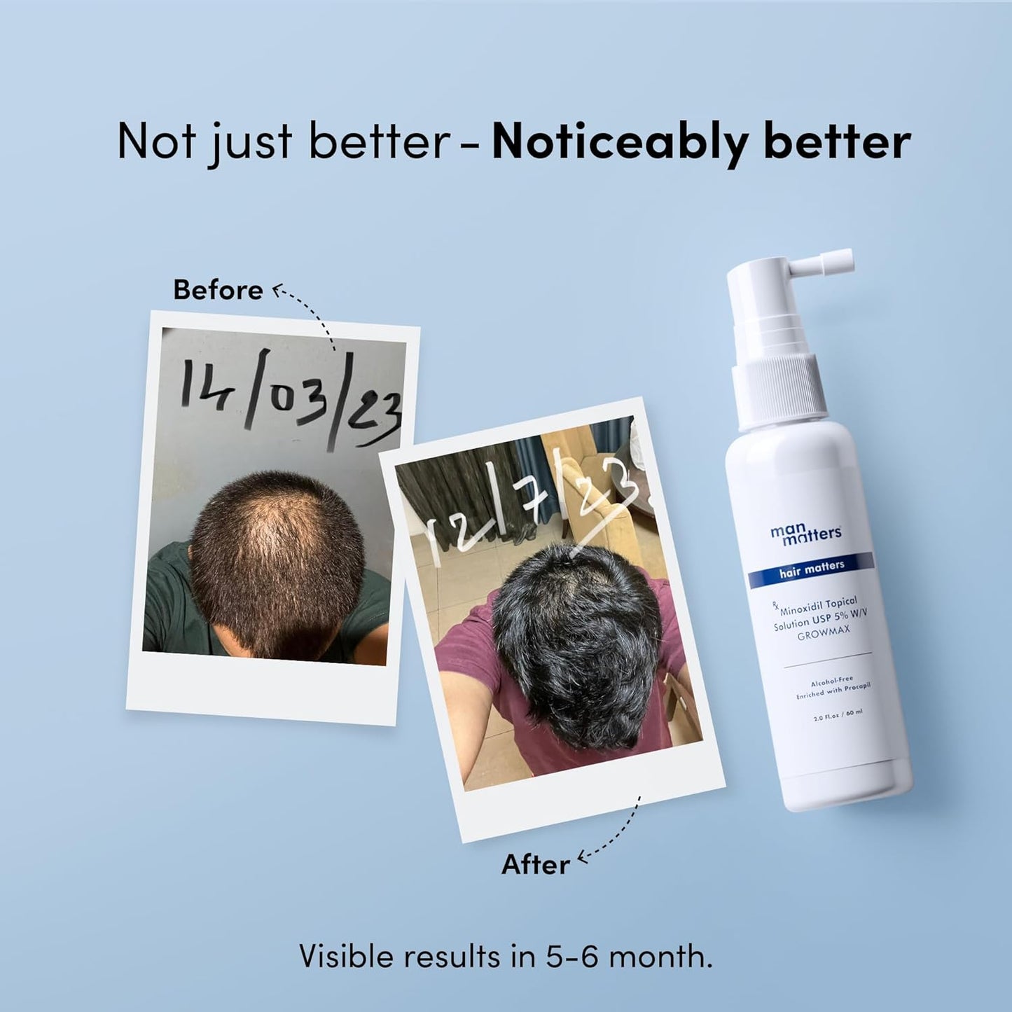 Minoxidil 50ml