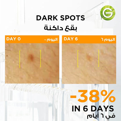 Garnier Fast Bright Vitamin C Brightening Ampoules For Dark Circles, Multipack, Hyperpigmentation Ampoules 3% Vitamin C & Niacinamide (12 X 1.5ml)