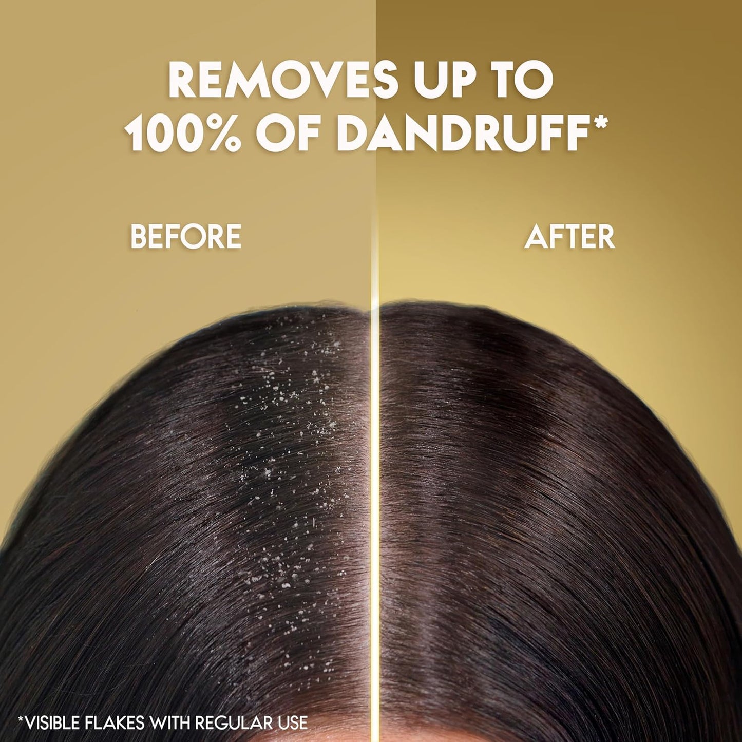 Head & Shoulders Supreme Anti-Dandruff Shampoo With Argan Oil And Aloe Vera For Sensitive Scalp Soothing, 200ml